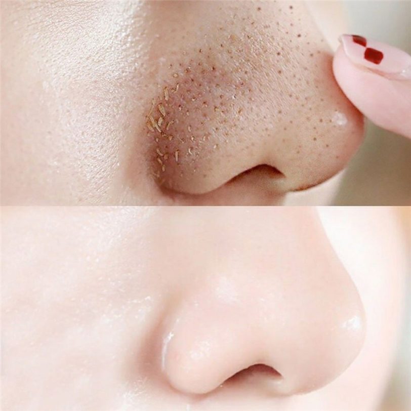 10 PCS Nose Blackhead Remover Mask Deep Cleansing Skin Care Shrink Pore Acne Treatment Mask Nose 2
