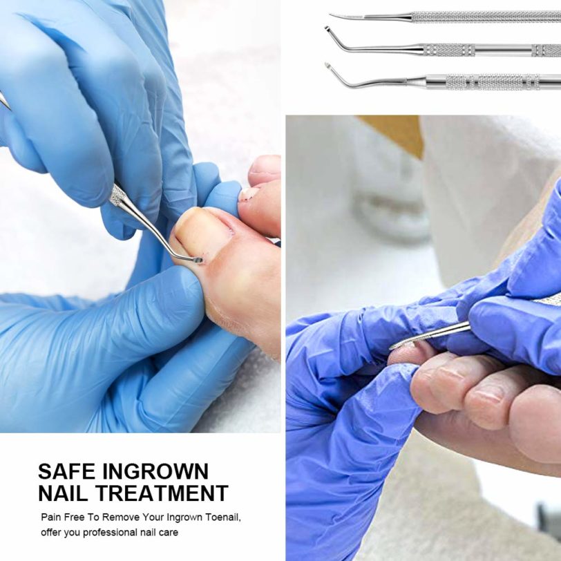 3pcs Ingrown Double Ended Ingrown Toe Correction Lifter File Toe Nail Care Manicure Pedicure Toenails Clean 1