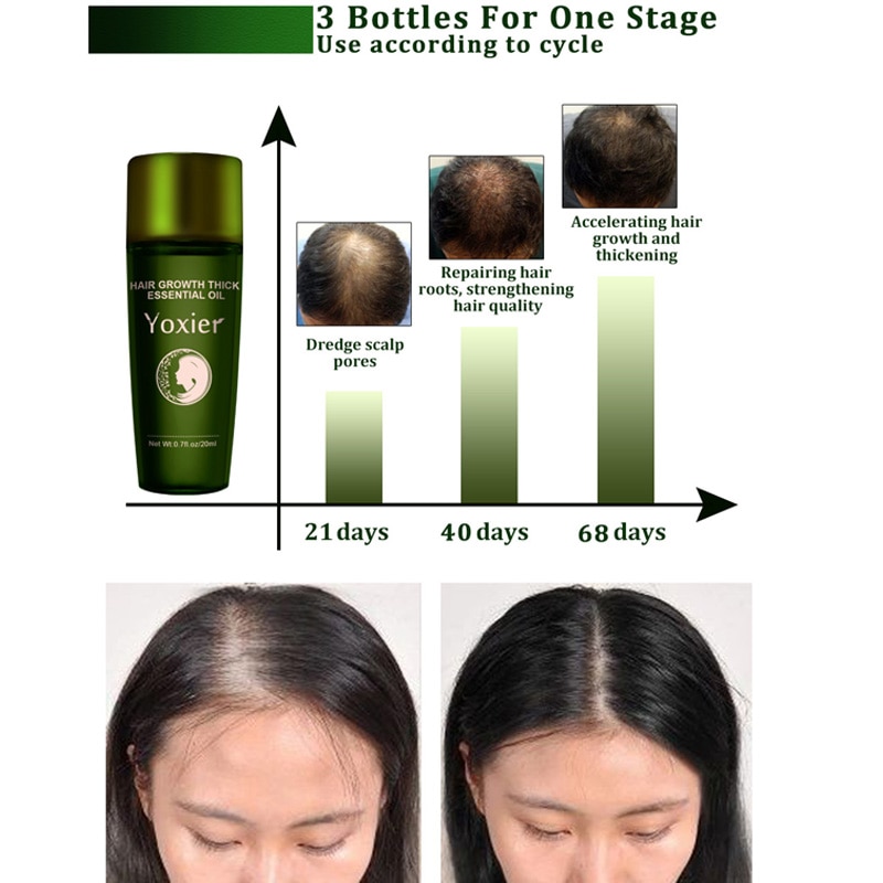 Effective Fast Growth Hair Care Serum Moisturizing Anti Hair Loss Scalp Repair Anti Dry Anti Breaking